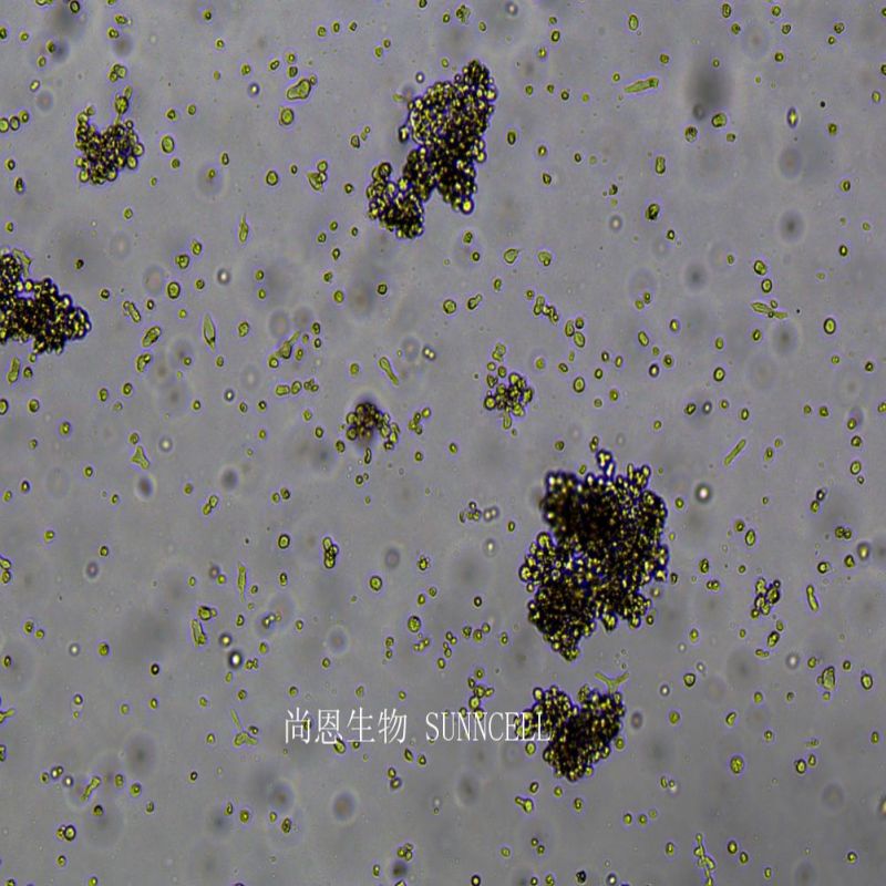 人弥漫大B细胞淋巴瘤细胞