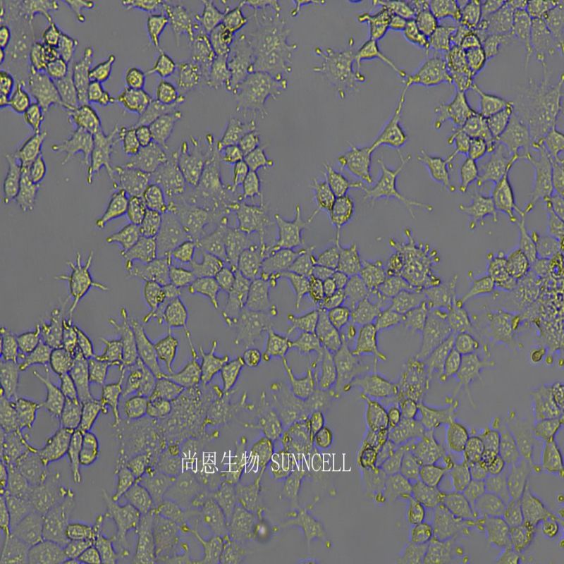 人胎盘绒毛癌细胞