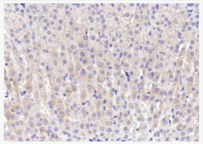 IGF2R/M6PR 胰岛素样生长因子2受体抗体