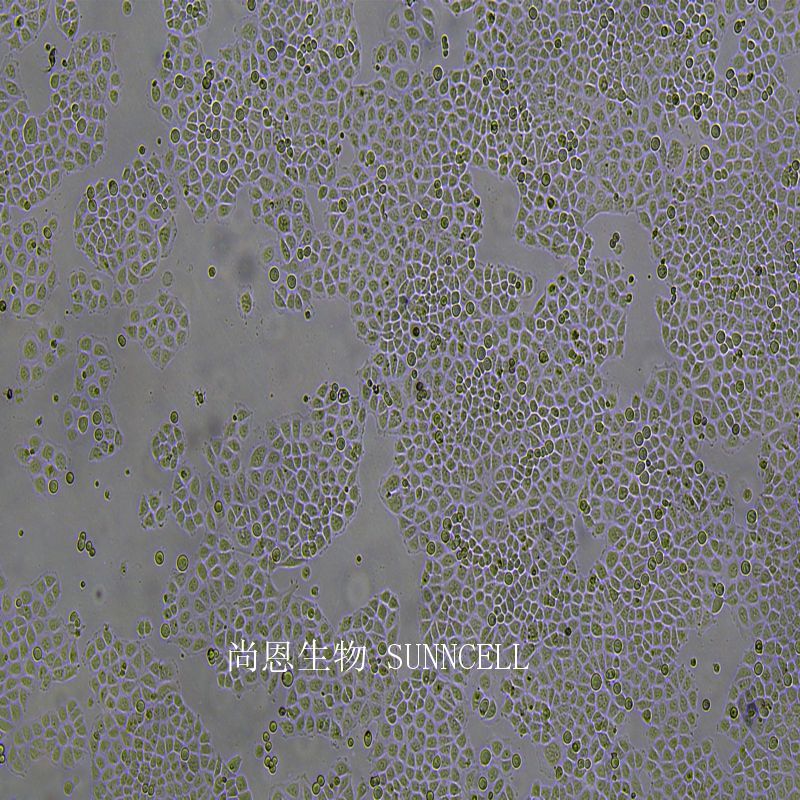 人肺巨细胞癌细胞(低转移)