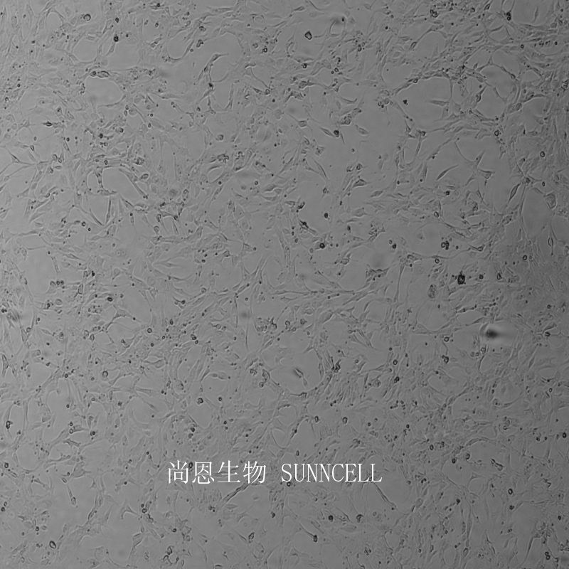 TB 1 LU蝙蝠肺细胞