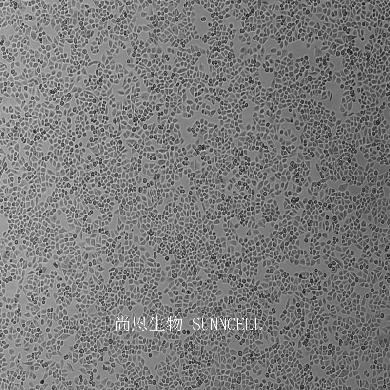 A2780人卵巢癌细胞