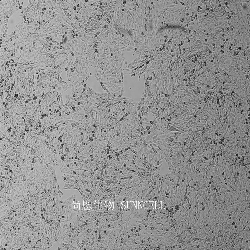 IBRS-2 [IB-RS-2猪肾细胞