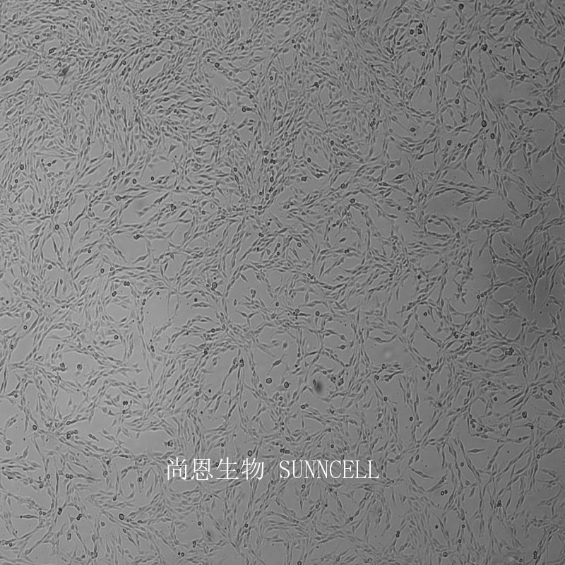 大鼠肾上腺嗜铬细胞瘤细胞(高分化)