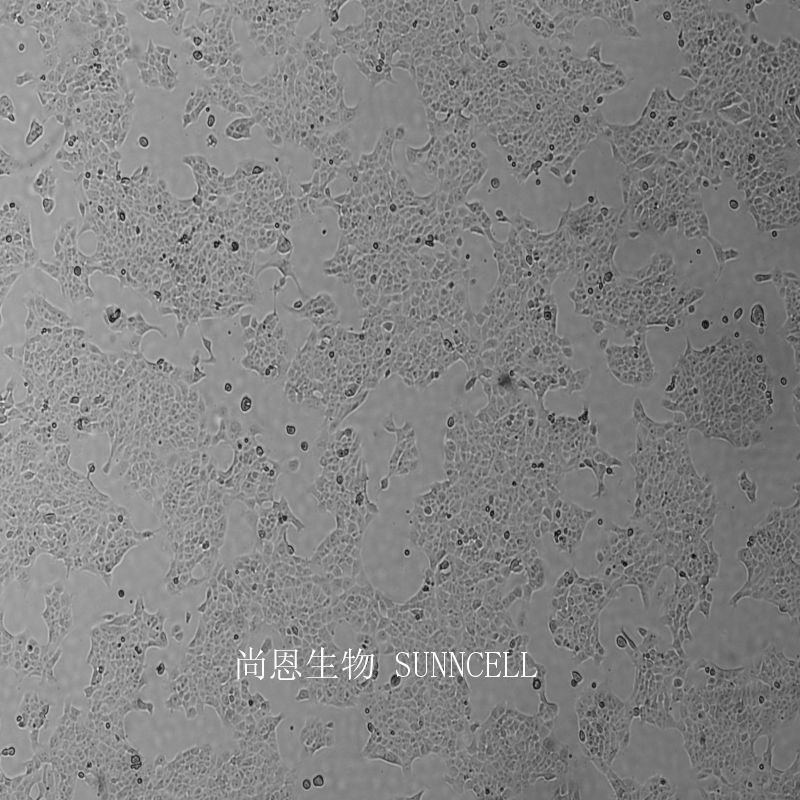 4T1小鼠乳腺癌细胞