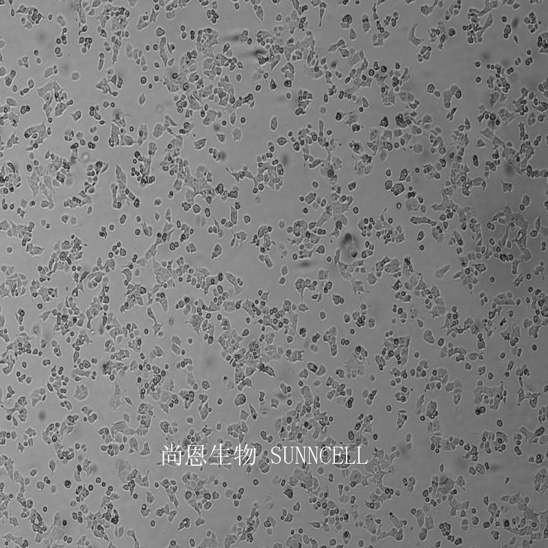 HEC-1-A人子宫内膜腺癌细胞