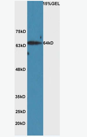 HAS2 透明质酸合成酶2抗体