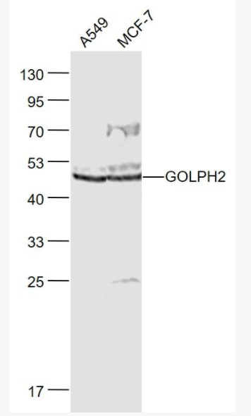 GOLPH2 高尔基体膜蛋白GP73抗体