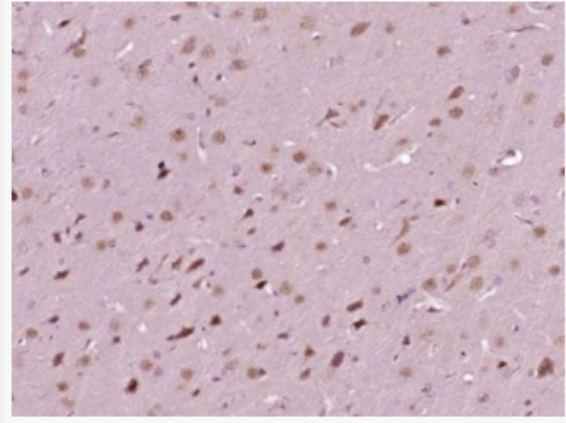 SATB2 DNA结合蛋白2抗体