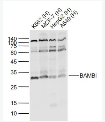BAMBI 肿瘤转移抑制蛋白BAMBI抗体