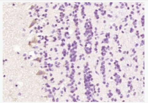 LC3 自噬微管相关蛋白轻链3抗体