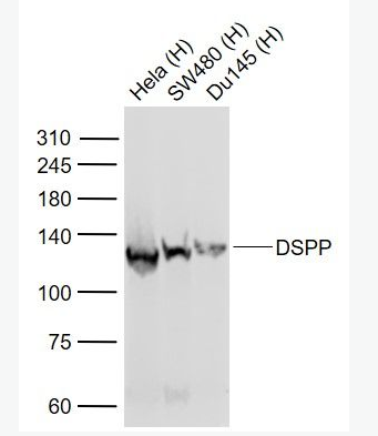 DSPP 牙本质磷蛋白/牙本质骨唾液酸糖蛋白/牙本质骨唾液酸磷蛋白抗体