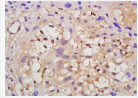 VEGFR2 血管内皮生长因子受体2抗体.
