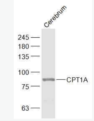 CPT1A 肉毒碱棕榈酰基转移酶1A抗体