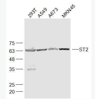 ST2 白细胞介素1受体相关蛋白抗体