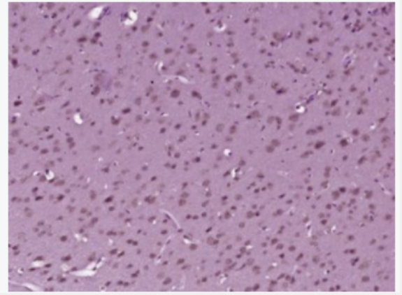 MDM2 双微体2癌基因抗体