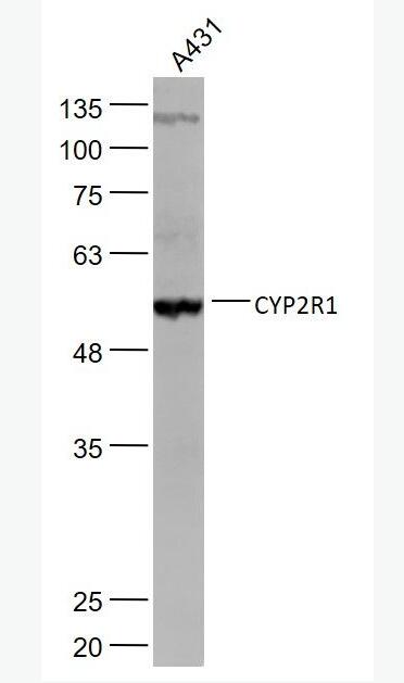 CYP2R1 细胞色素P450 2R1抗体