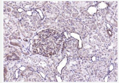 ITGAV 整合素αV（CD51）抗体