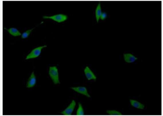 IL-2R gamma 白介素2受体γ链抗体