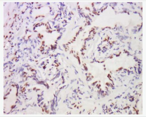 MST1 蛋白激酶MST抗体