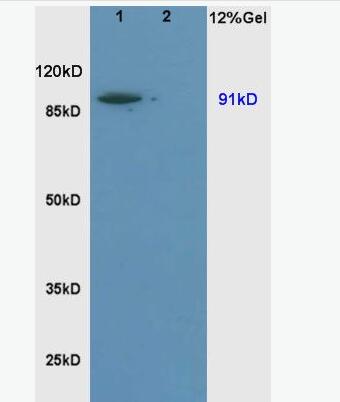 Sodium hydrogen exchanger 1 钠氢通道蛋白抗体