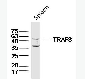 TRAF3 肿瘤坏死因子受体相关蛋白3抗体