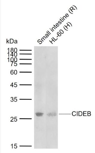 CIDEB 细胞死亡激活剂CIDE-B抗体