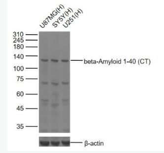 beta-Amyloid 1-40 (CT)  β淀粉样肽1-40 C端/Aβ1-40 C端抗体