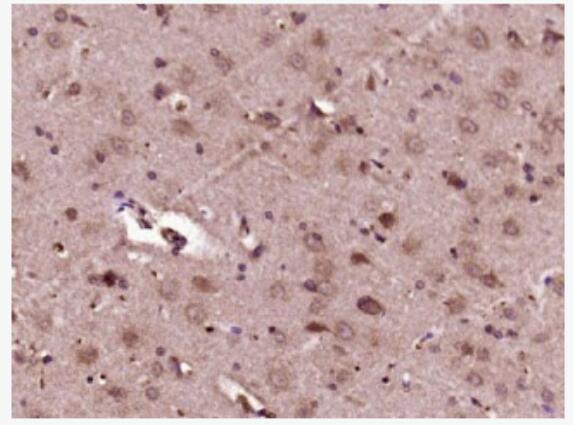 MEK1 + MEK2 丝裂原活化蛋白激酶激酶1抗体