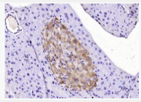 IRS-2 胰岛素受体底物-2抗体