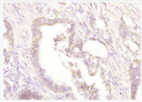 IL-6  白介素6抗体