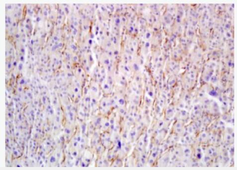 Hyaluronidase-1 透明质酸酶/玻璃酸酶抗体