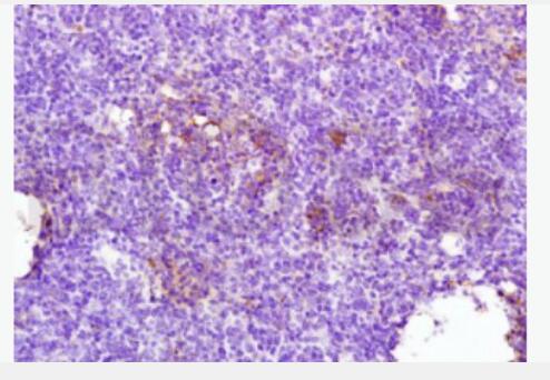 CTLA4 细胞毒性T细胞抗原-4（CD152）抗体