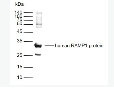 Anti-RAAnti-RAMP1 antibody -受体活性修饰蛋白1抗体MP1 antibody -受体活性修饰蛋白1抗体