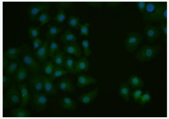 Anti-CEBP-alpha antibody -转录调节因子C/EBP α 抗体