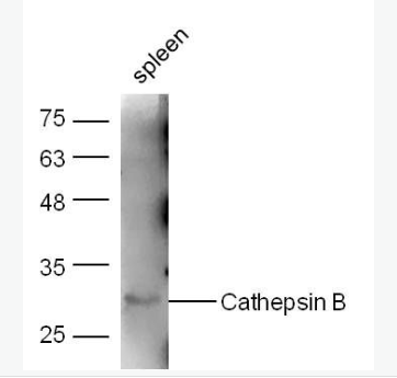 Anti-Cathepsin B antibody -组织蛋白酶B抗体