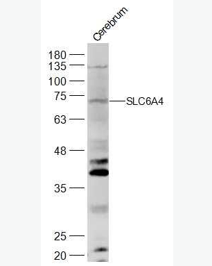 Anti-Serotonin transporter antibody -5-羟色胺转运蛋白抗体