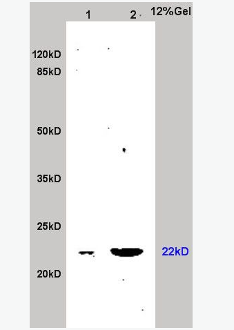 Anti-Peroxiredoxin 3 antibody -硫氧还蛋白还原酶3抗体