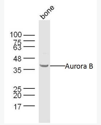 Anti-Aurora B antibody -有丝分裂激酶B抗体