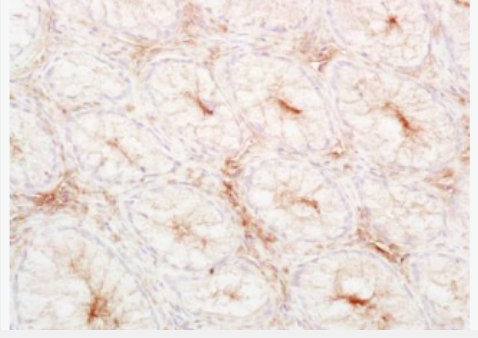 Anti-LDL antibody -低密度脂蛋白抗体