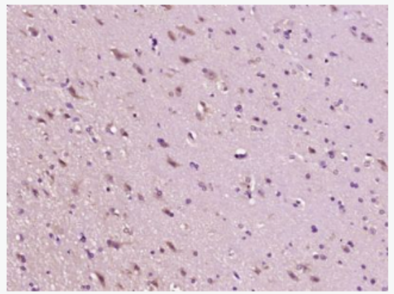 Anti-CD30 antibody -CD30抗体