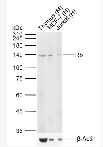 Anti-Rb antibody -成视网膜细胞瘤基因抗体