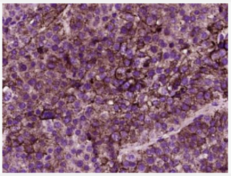 Anti-CD26 antibody -CD26/DPP4抗体