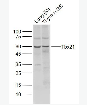 Anti-Tbx21 antibody -T细胞介导的转录调节因子Tbx21抗体
