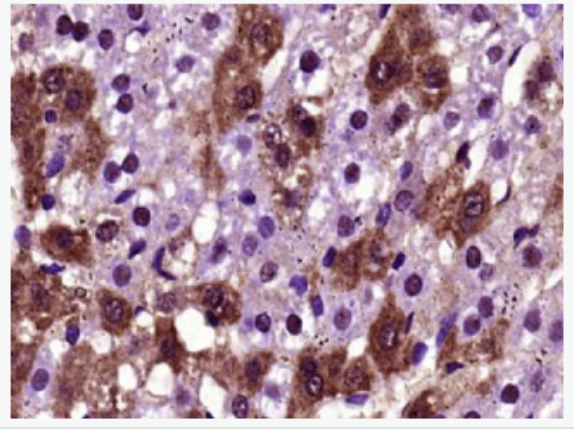 Anti-FGF21 antibody -成纤维细胞生长因子21抗体