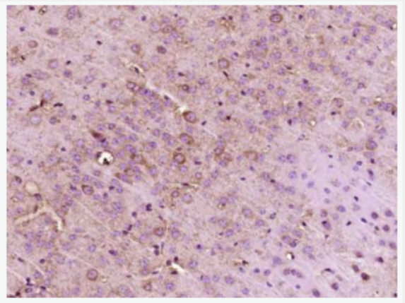 Anti-PER2 antibody -节律蛋白2抗体