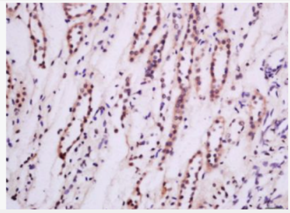 Anti-PKC epsilon antibody -蛋白激酶C抗体