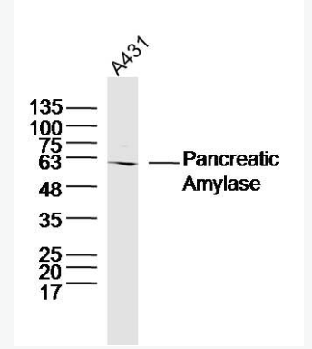 Anti-Pancreatic Amylase antibody -胰淀粉酶抗体