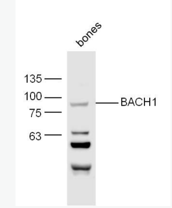 Anti-BACH1 antibody -转录调节蛋白BACH1抗体