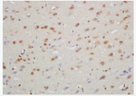 Anti-TXNIP antibody -硫氧还蛋白结合蛋白2抗体